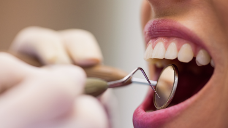 Dentistry Myths Debunked: Separating Fact from Fiction