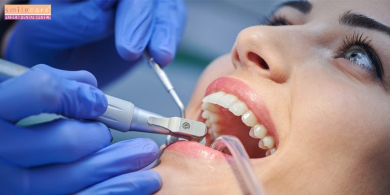 Smile Confidently: The Expertise and Care of a Reputed Dentist